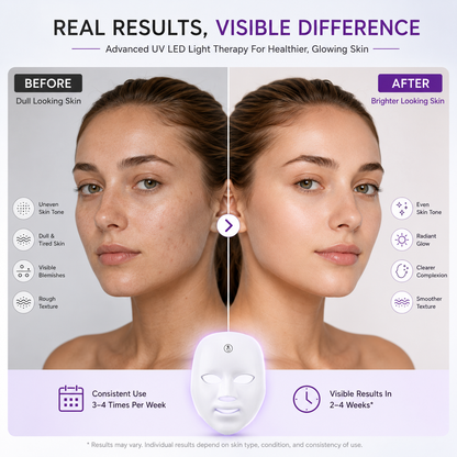 UV LED Face Mask – Advanced Light Therapy Skincare Device for Radiant & Youthful-Looking Skin